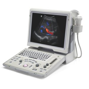 This image has an empty alt attribute; its file name is Z5-Ultrasound-System.jpg